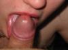 oral