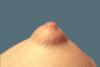 Nippel Nippel